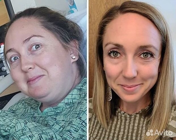 Путь к уменьшению жировой прослойки в Новокузнецке