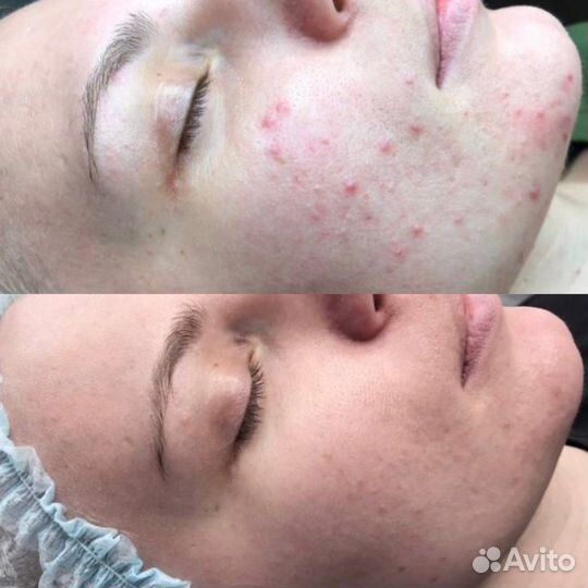 Требуются модели