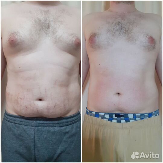 Аппаратная коррекция фигуры