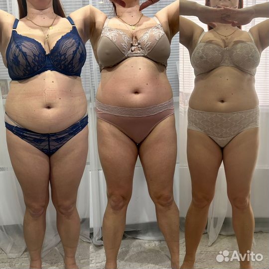 Антицеллюлитный массаж