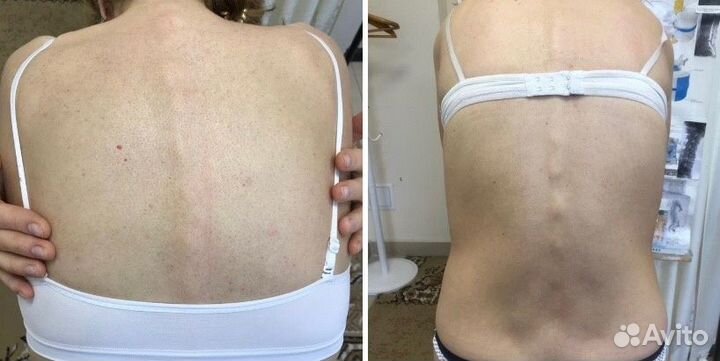 Костоправ, мануальный массаж, мед. образование