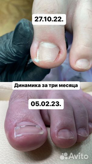 Подолог, изготовление стелек