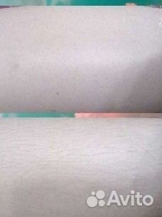 Шугаринг (только женский)