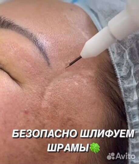 Косметолог/ Холодная плазма