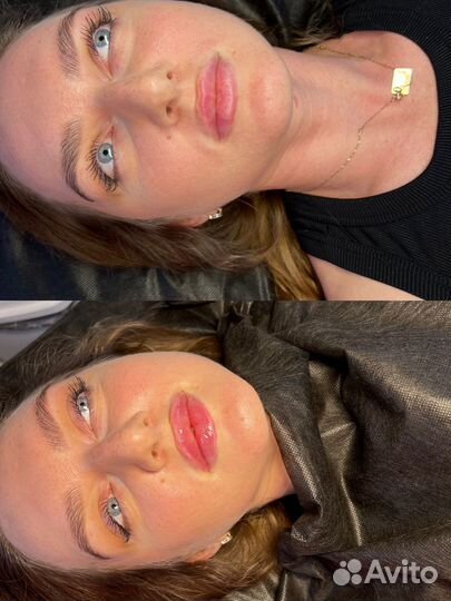 Модель на увеличение губ, Краснодар