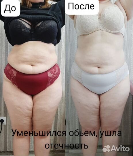 Аппаратный антицеллюлитный массаж