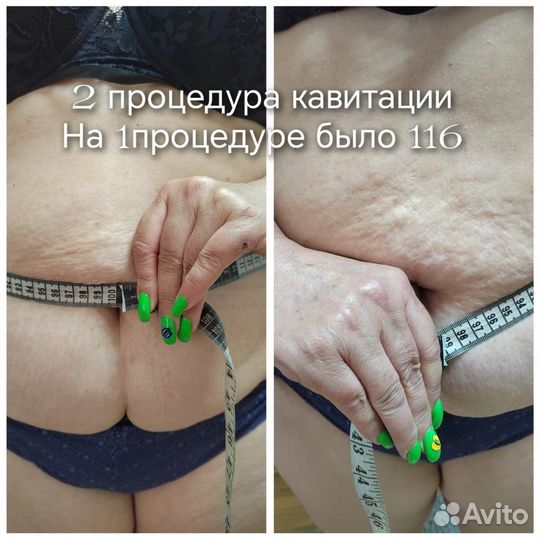 Спа процедуры