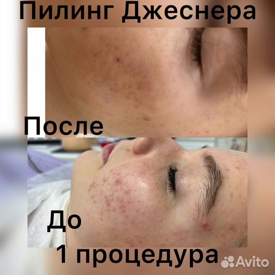 Мастер по наращиванию ресниц, косметолог