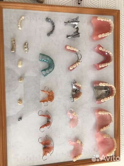 Изготовление и ремонт съемных зубных протезов