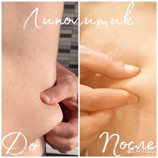 Косметолог: чистка, пилинг, мезотерапия