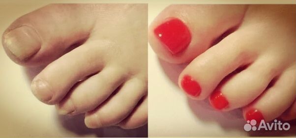 Маникюр педикюр на дому