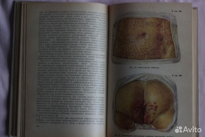 Советские учебники Кожные и венерические болезни