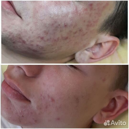 Косметология/ депиляция/обучение депиляции