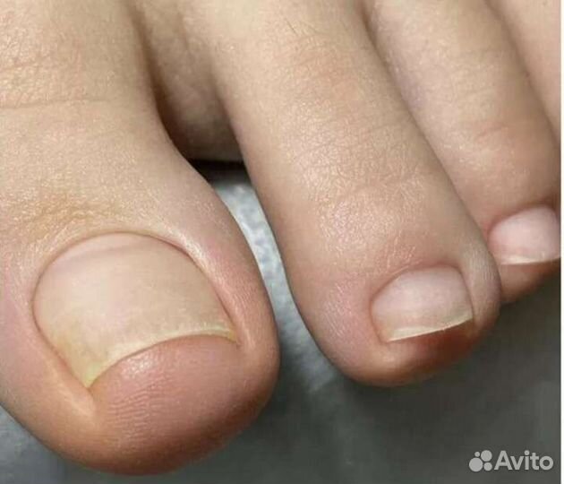 Аппаратный педикюр/эстетика, подология