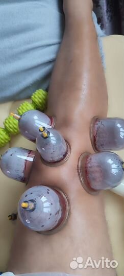 Хиджама (обучение) / капиляротерапия лица