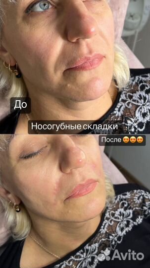 Услуги косметолога