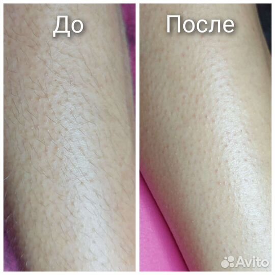 Шугаринг, Воск, Ароматическая SPA-депиция