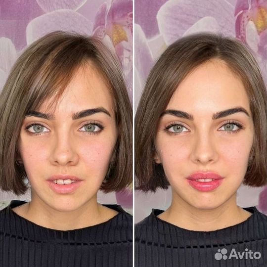 Врач косметолог