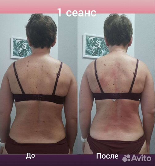 Костоправ. Владимир