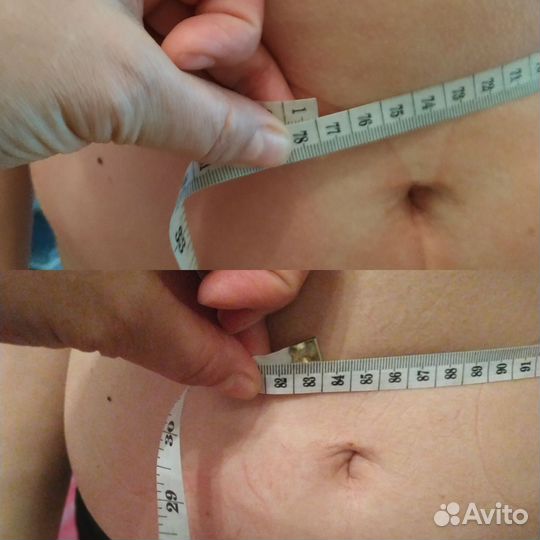 Вакуумный массаж,кавитация