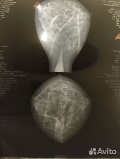 Рентгеновский снимок мрт