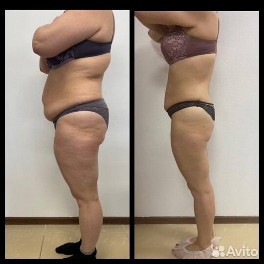 Ищем модель на коррекцию фигры