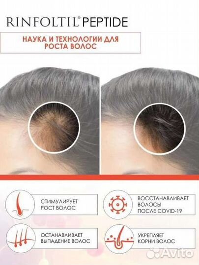 Сыворотка Для роста и против выпадения волос