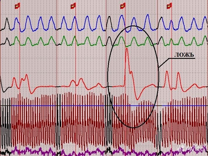 Полиграф, детектор лжи