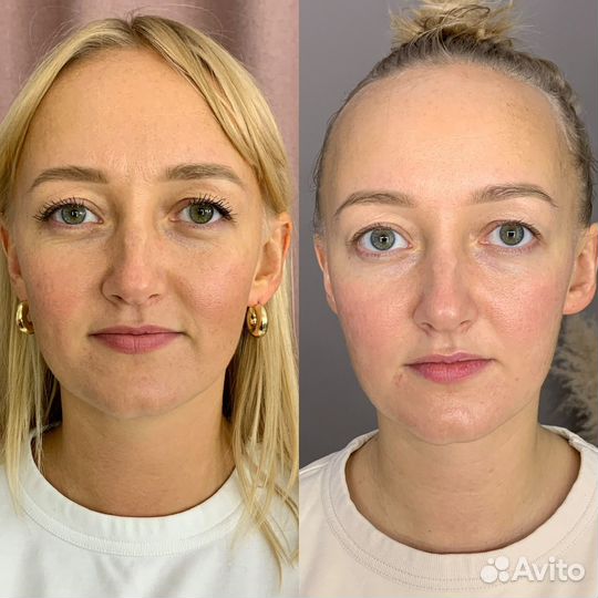 Скульптурный массаж лица. Буккальный