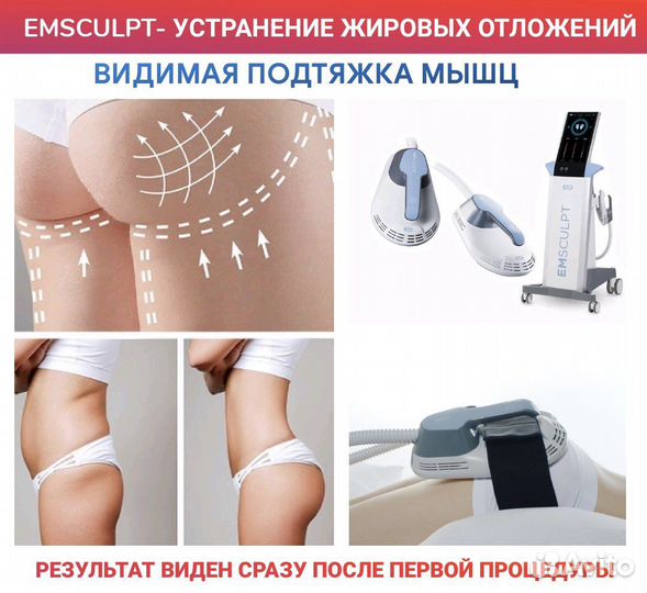 Жиросжигающая процедура emsculpt
