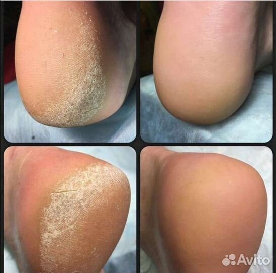 Педикюр модели