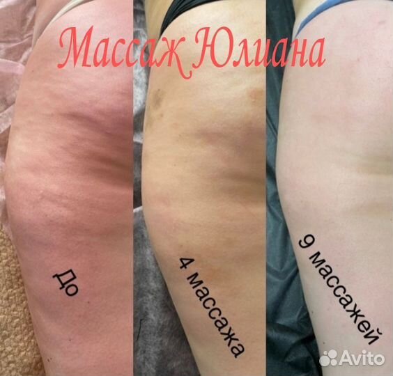 Массаж коррекция фигуры