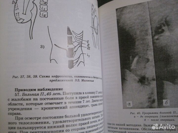 B. 3. Маховский одномоментные сочетанные операции