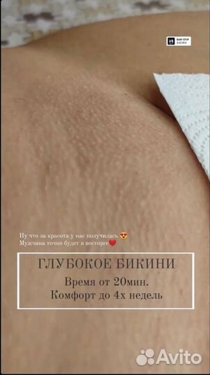 Восковая депиляция