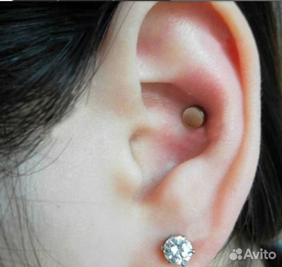 Клипсы для похудения