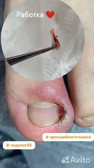 Услуги подолога, мужской педикюр