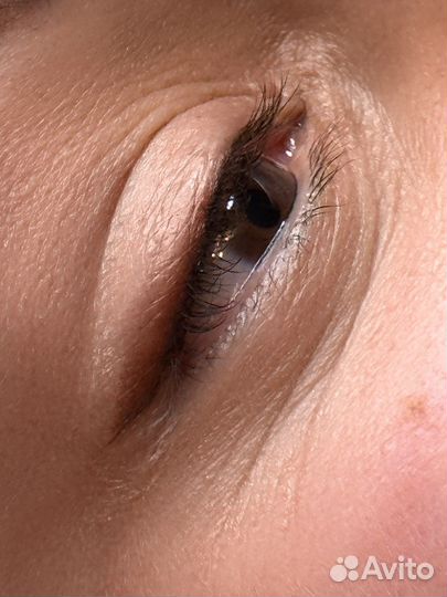 Перманентный макияж, камуфляж шрамов