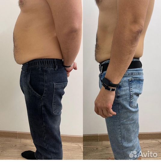 Курс Криолиполиза для мужчин