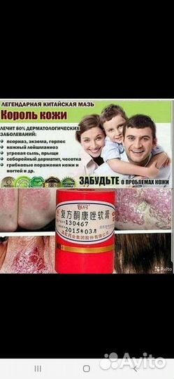 Мазь от псориаза