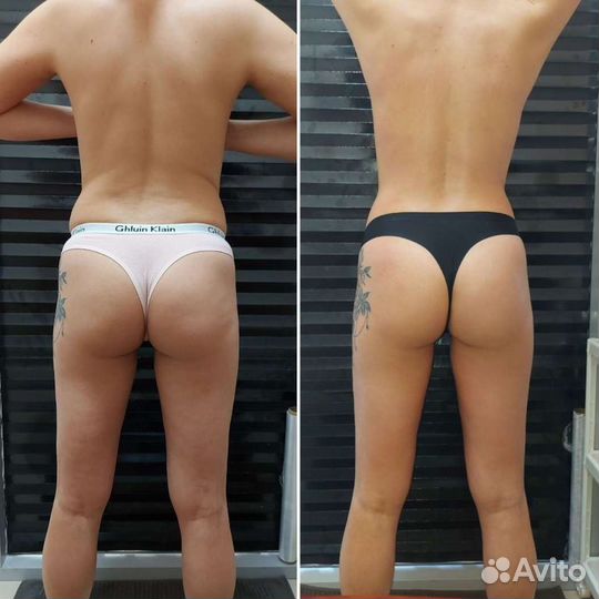 Массаж коррекция фигуры