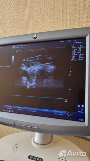 Аппарат узи