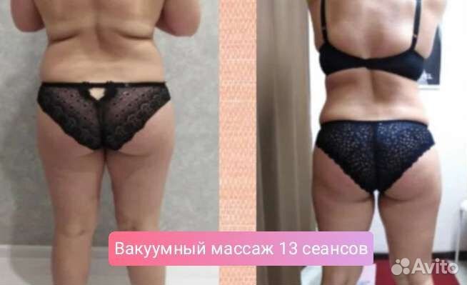 Вакуумный массаж Вибрационный массаж Прессотерапия
