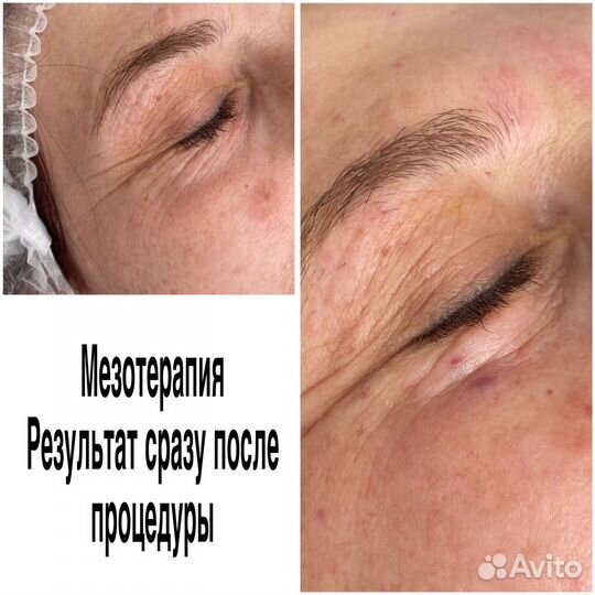 Услуги косметолога