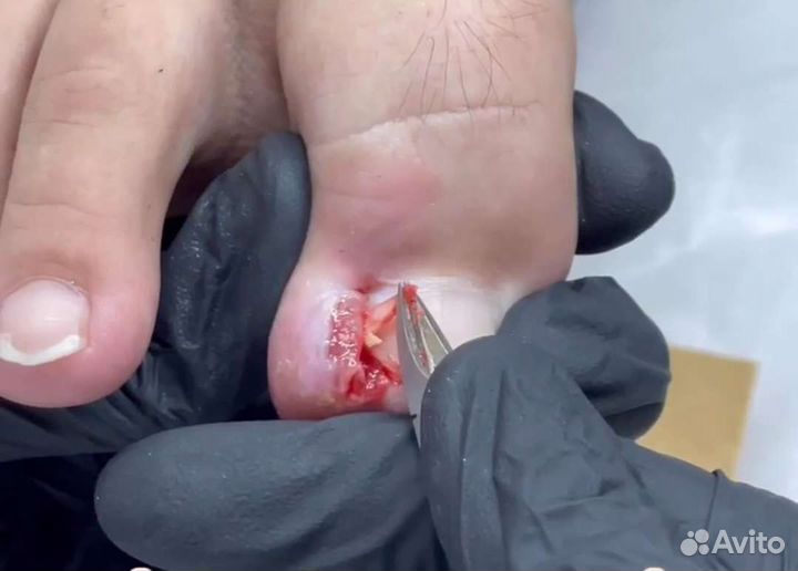 Услуги подолога