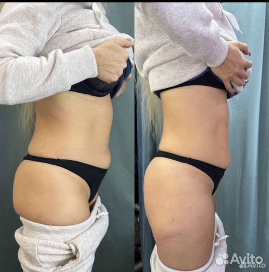 Худеем за неделю