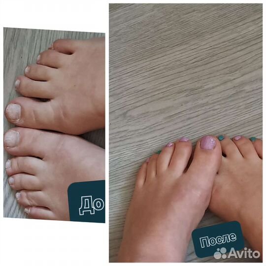 Нужны модели на маникюр и педикюр