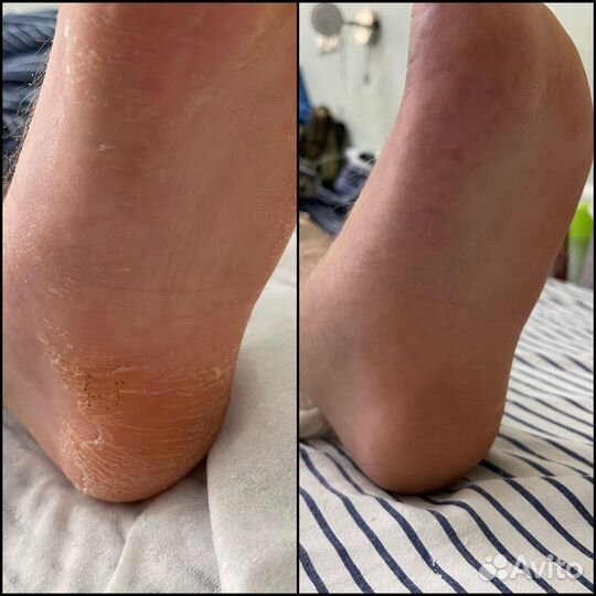 Подолог. педикюр. маникюр