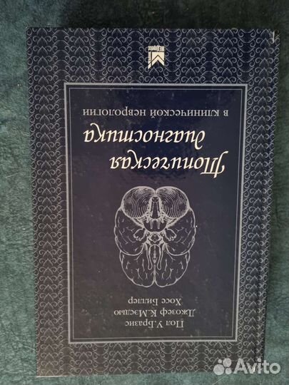 Топическая диагностика