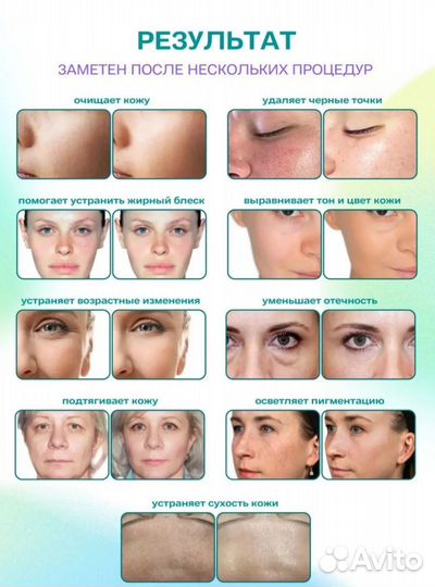 Ультразвуковой аппарат для чистки лица