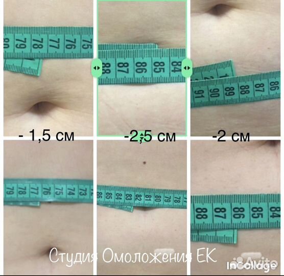 Липосоникс liposonix